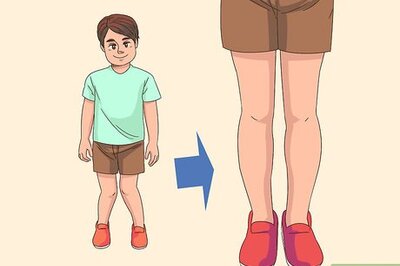 How to Cure Knock Knees Naturally